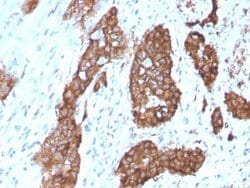 PDLIM1 Antibody (CPTC-PDLIM1-1) - Azide and BSA Free, Novus Biologicals